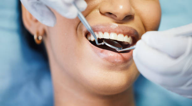 Best Emergency Cosmetic Dentistry in New Philadelphia, OH